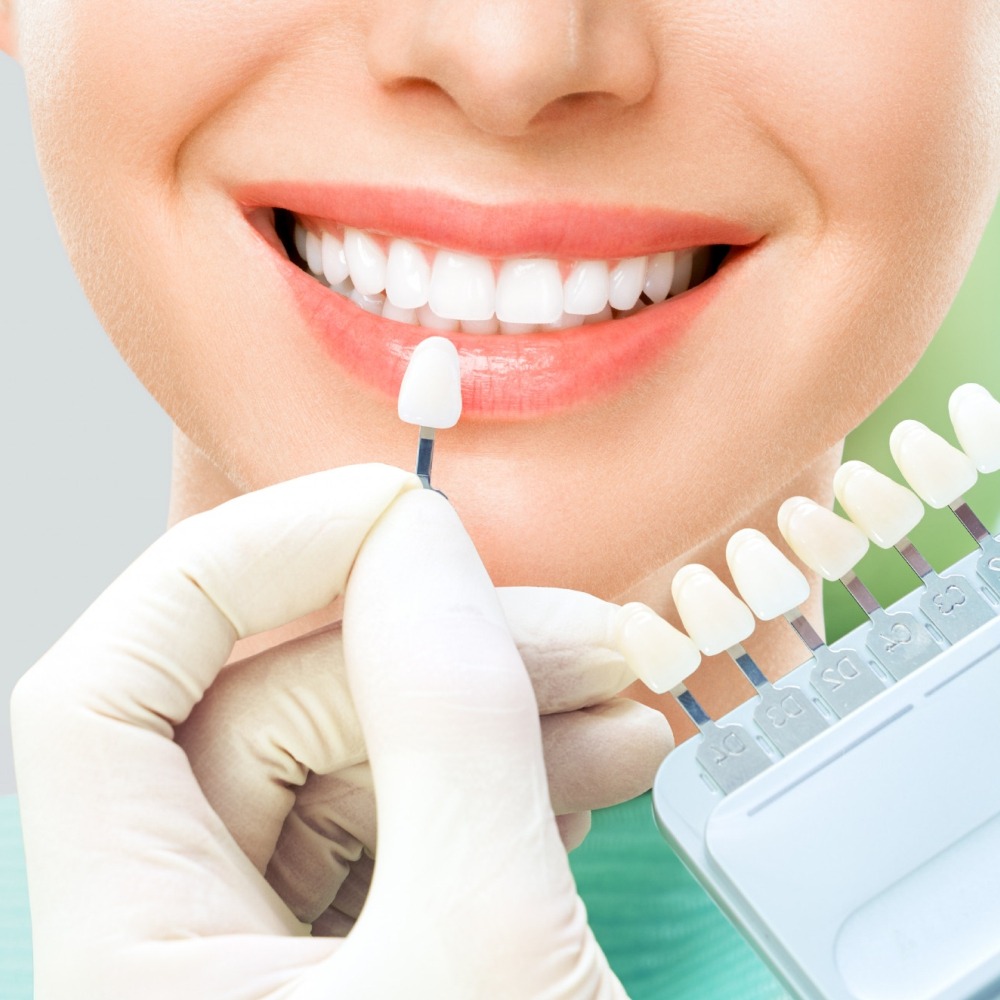 Dentística Estética - Odonto Company Iguaba Grande